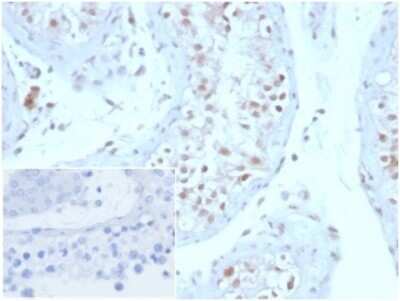 Immunohistochemistry-Paraffin: Geminin Antibody (GMNN/3665) [NBP3-13992]