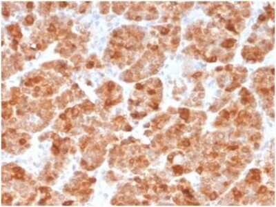 Immunohistochemistry-Paraffin: Geminin Antibody (GMNN/3665) [NBP3-13992]