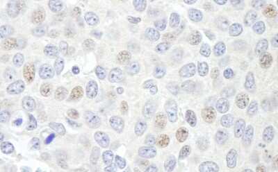 Immunohistochemistry: Geminin Antibody [NB100-40826]