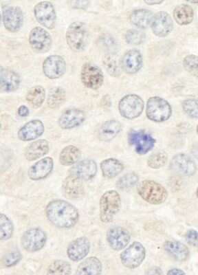Immunohistochemistry-Paraffin: Geminin Antibody [NB100-40827]