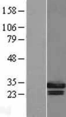 Western Blot: Geminin Overexpression Lysate [NBL1-11143]