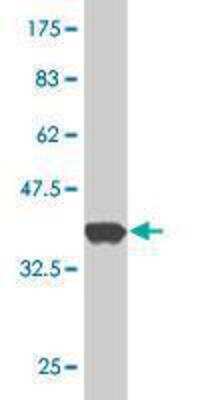 Western Blot: Genethonin 1 Antibody (2C10) [H00008987-M11]