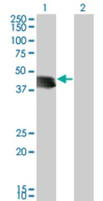 Western Blot: Genethonin 1 Antibody (4H4) [H00008987-M03]