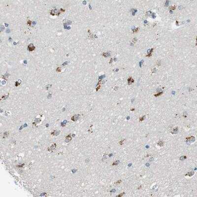 Immunohistochemistry: Genethonin 1 Antibody [NBP1-91936]
