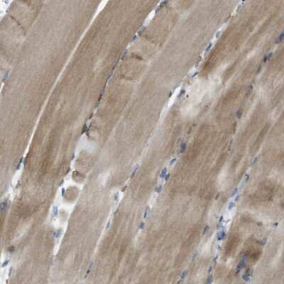 Immunohistochemistry-Paraffin: Genethonin 1 Antibody [NBP1-91936]
