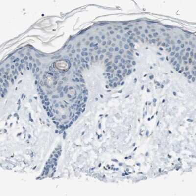 Immunohistochemistry-Paraffin: Genethonin 1 Antibody [NBP1-91936]