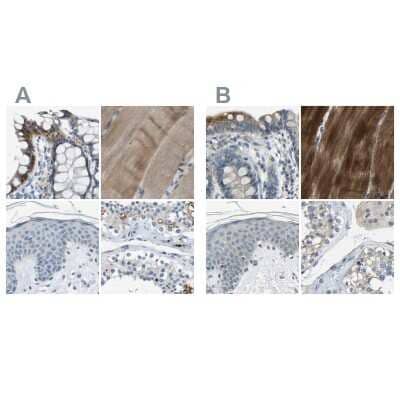 Immunohistochemistry-Paraffin: Genethonin 1 Antibody [NBP1-91936]