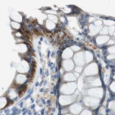 Immunohistochemistry-Paraffin: Genethonin 1 Antibody [NBP1-91936]