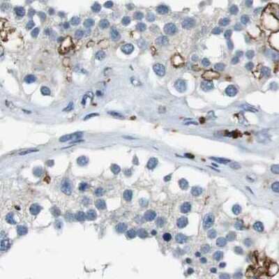 Immunohistochemistry-Paraffin: Genethonin 1 Antibody [NBP1-91936]