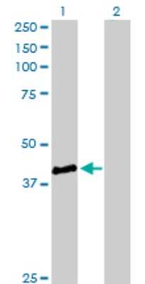 Western Blot: Genethonin 1 Antibody [H00008987-D01P]