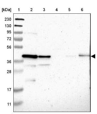 Western Blot: Genethonin 1 Antibody [NBP1-91935]