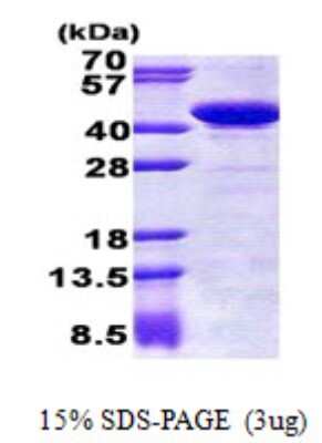 SDS-PAGE: Recombinant Human Genethonin 1 His Protein [NBP2-22828]