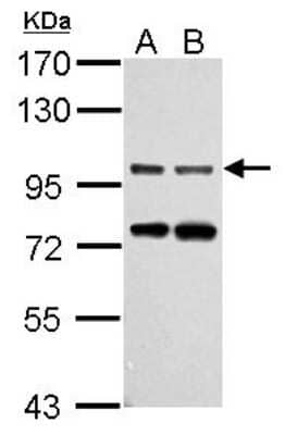 Western Blot: Gephyrin/GPHN Antibody [NBP2-16641]
