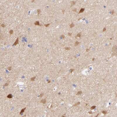 Immunohistochemistry-Paraffin: Gephyrin/GPHN Antibody [NBP1-87875]