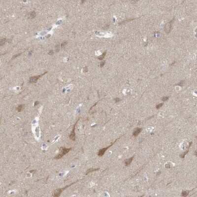 Immunohistochemistry-Paraffin: Gephyrin/GPHN Antibody [NBP1-87876]