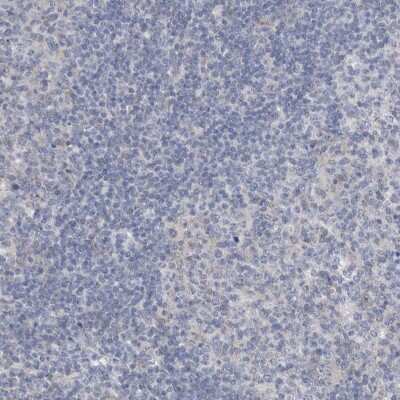 Immunohistochemistry-Paraffin: Gephyrin/GPHN Antibody [NBP1-87876]