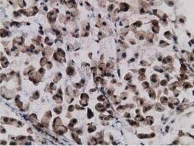 Immunohistochemistry: Gephyrin/GPHN Antibody (OTI3B6) - Azide and BSA Free [NBP2-71556]