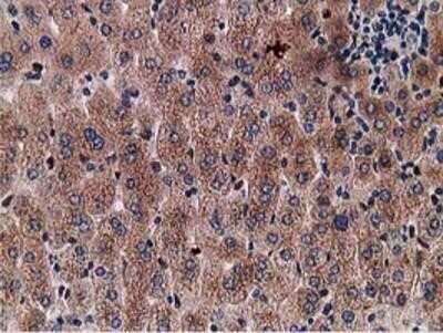 Immunohistochemistry: Gephyrin/GPHN Antibody (OTI3B6) - Azide and BSA Free [NBP2-71556]