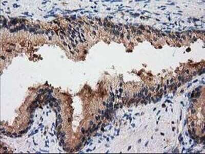 Immunohistochemistry: Gephyrin/GPHN Antibody (OTI3B6) - Azide and BSA Free [NBP2-71556]