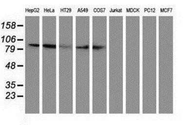 Western Blot: Gephyrin/GPHN Antibody (OTI3B6)Azide and BSA Free [NBP2-71556]