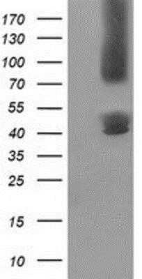 Western Blot: Gephyrin/GPHN Antibody (OTI3B6)Azide and BSA Free [NBP2-71556]