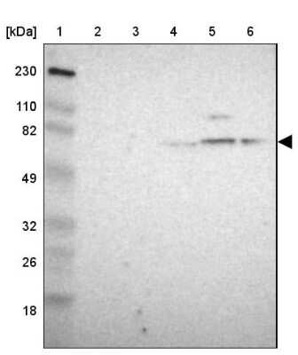 Western Blot: Gephyrin/GPHN Antibody [NBP1-87875]