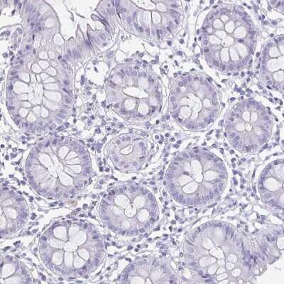 Immunohistochemistry-Paraffin: Ghrelin/Obestatin Antibody [NBP1-89773]