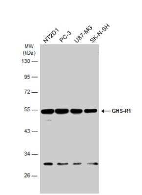 Western Blot: Ghrelin Receptor/GHSR Antibody [NBP2-16655]