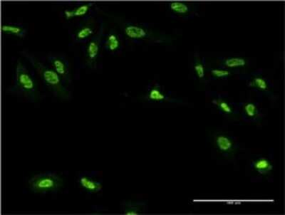 Immunocytochemistry/ Immunofluorescence: Gigaxonin Antibody (4G7) [H00008139-M01]