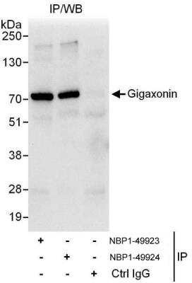 Immunoprecipitation: Gigaxonin Antibody [NBP1-49923]