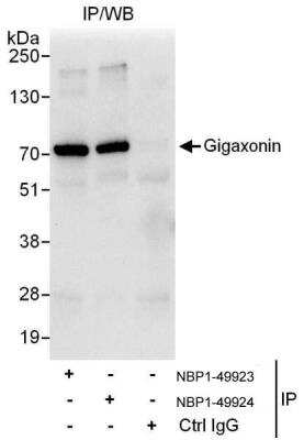Immunoprecipitation: Gigaxonin Antibody [NBP1-49924]