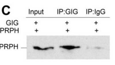 Immunoprecipitation: Gigaxonin Antibody [NBP1-49924]