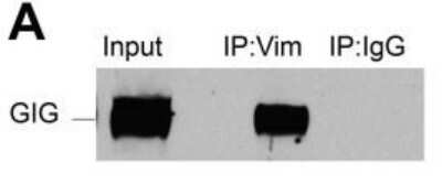 Western Blot: Gigaxonin Antibody [NBP1-49924]