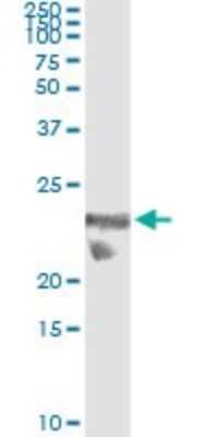 Immunoprecipitation: GilZ Antibody (3A5) [H00001831-M01]