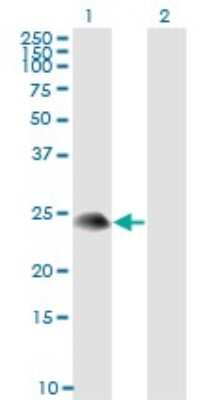 Western Blot: GilZ Antibody (3A5) [H00001831-M01]