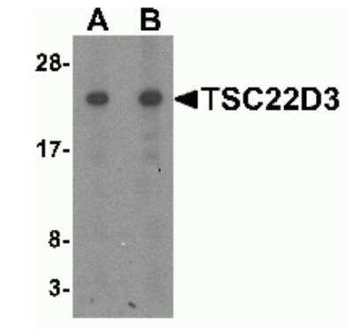 Western Blot: GilZ AntibodyBSA Free [NBP2-41210]