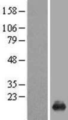 Western Blot: GilZ Overexpression Lysate [NBL1-17352]