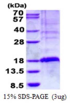 SDS-PAGE: Recombinant Human GilZ His Protein [NBP2-22895]