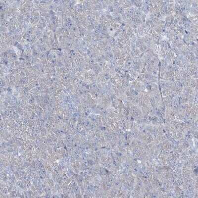 Immunohistochemistry-Paraffin: Girdin Antibody [NBP2-38387]