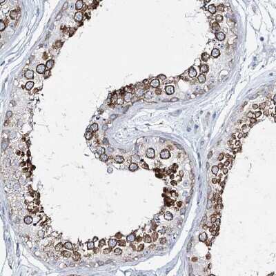 Immunohistochemistry-Paraffin: Girdin Antibody [NBP2-38387]