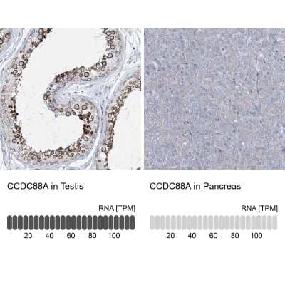 Immunohistochemistry-Paraffin: Girdin Antibody [NBP2-38387]