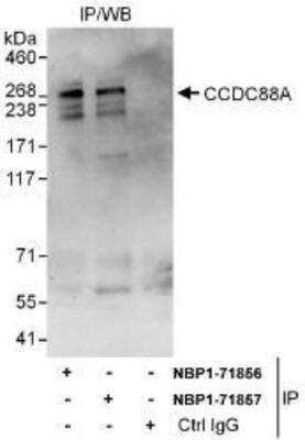 Immunoprecipitation: Girdin Antibody [NBP1-71856]