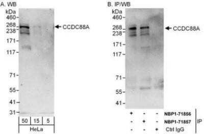 Western Blot: Girdin Antibody [NBP1-71857]