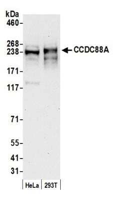 Western Blot: Girdin Antibody [NBP1-71857]