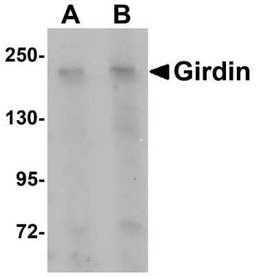 Western Blot: Girdin AntibodyBSA Free [NBP1-76253]