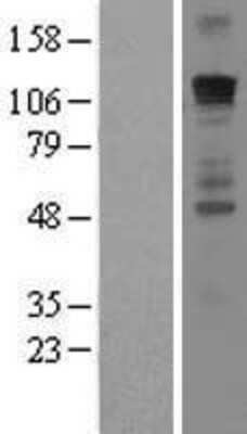 Western Blot: GLI-1 Overexpression Lysate [NBL1-11109]