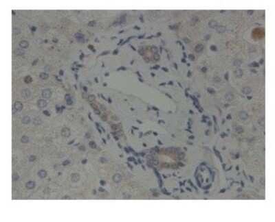 Immunohistochemistry: GliS2 Antibody [NBP2-84979]