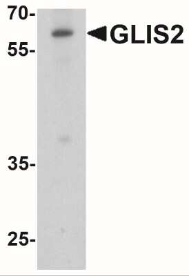 Western Blot: GliS2 AntibodyBSA Free [NBP2-41311]