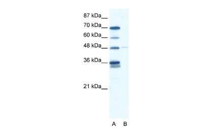 Western Blot: GliS2 Antibody [NBP2-84978]