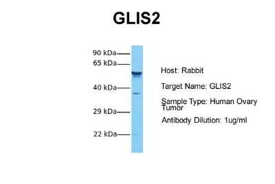 Western Blot: GliS2 Antibody [NBP2-84979]